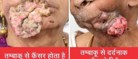 India_Pictorial warnings and quitline